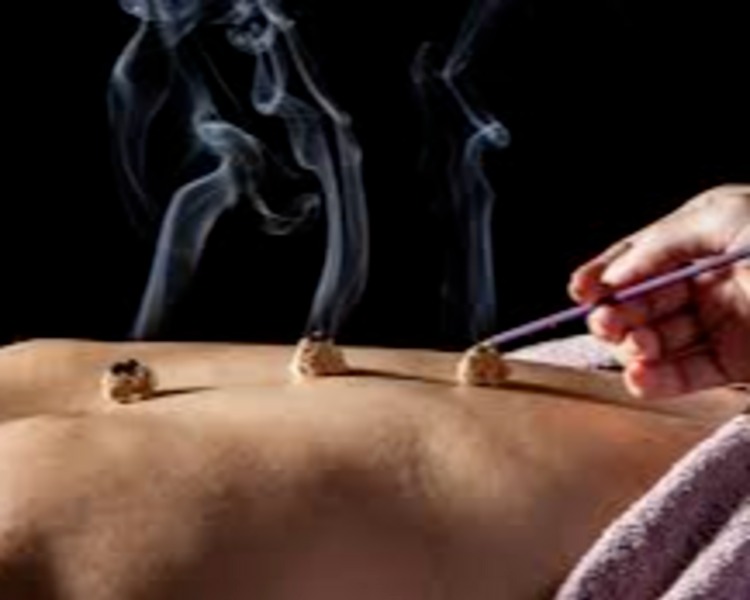 Acupuntura - Medicina China